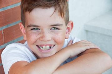 Boy-with-ortho-appliance.jpg