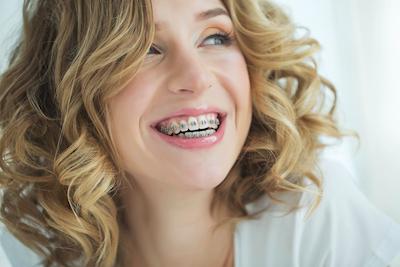 curly-hair-woman-with-braces.jpg