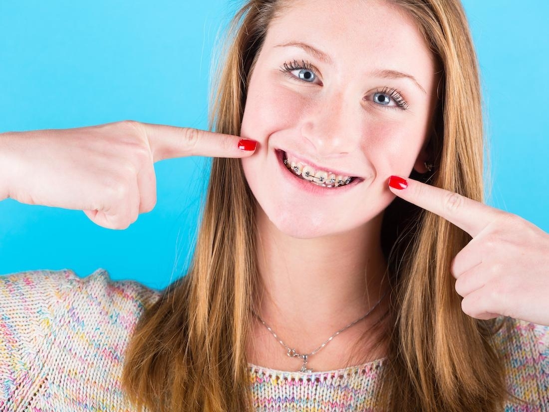 orthodontics-and-invisalign-staten-island-ny-gpw-main-service